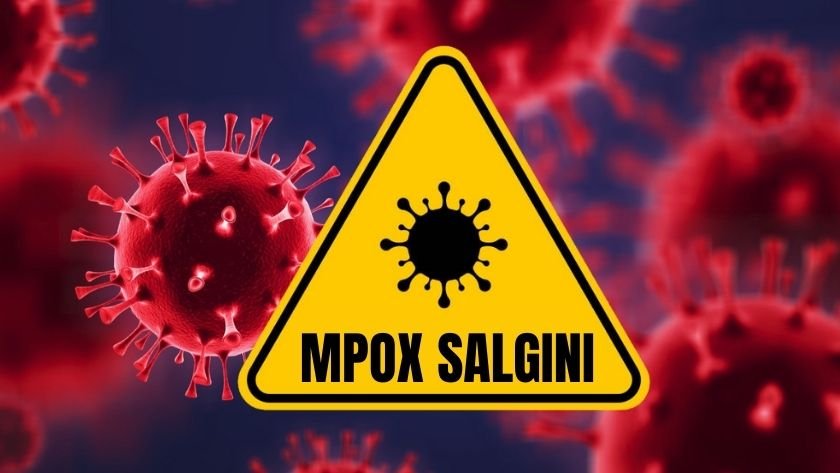 Mpox salgını yayılıyor: Küresel risk orta seviyede