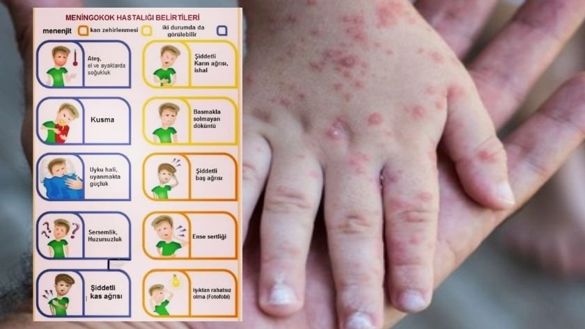 Umre kaynaklı meningokok hastalığı - TurizmPolitika Umre kaynaklı meningokok hastalığı
